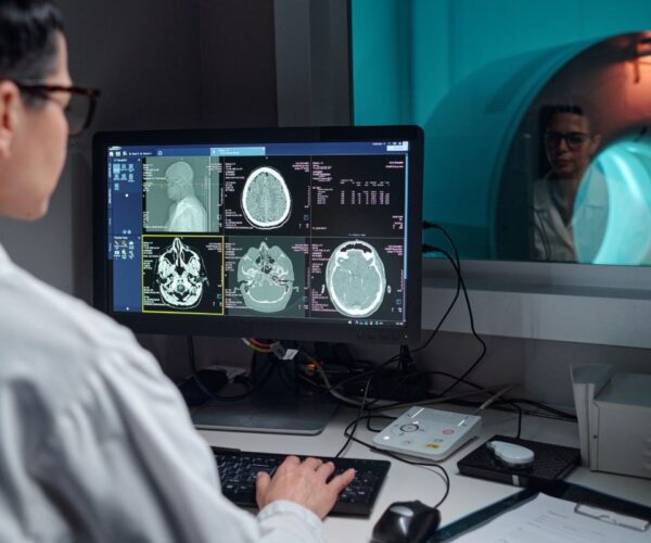 GammaKnifeRadiosurgery